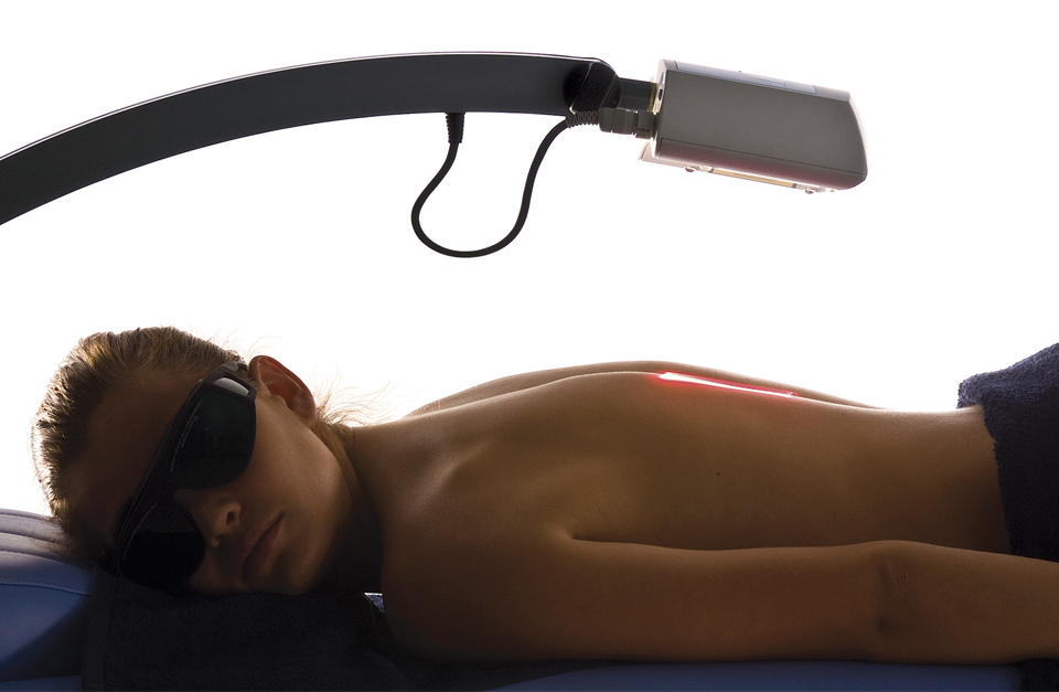 Biostimulation Laser Therapy